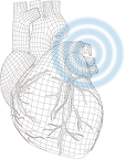 Echocardiogram