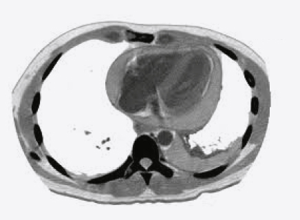 Structural abnormalities